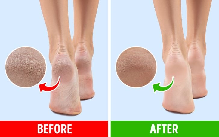 Có nên đi tất lúc ngủ? - 5