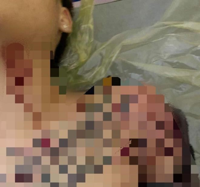Khởi tố vụ án nổ súng khiến nam thanh niên trọng thương ở Thái Bình - 2