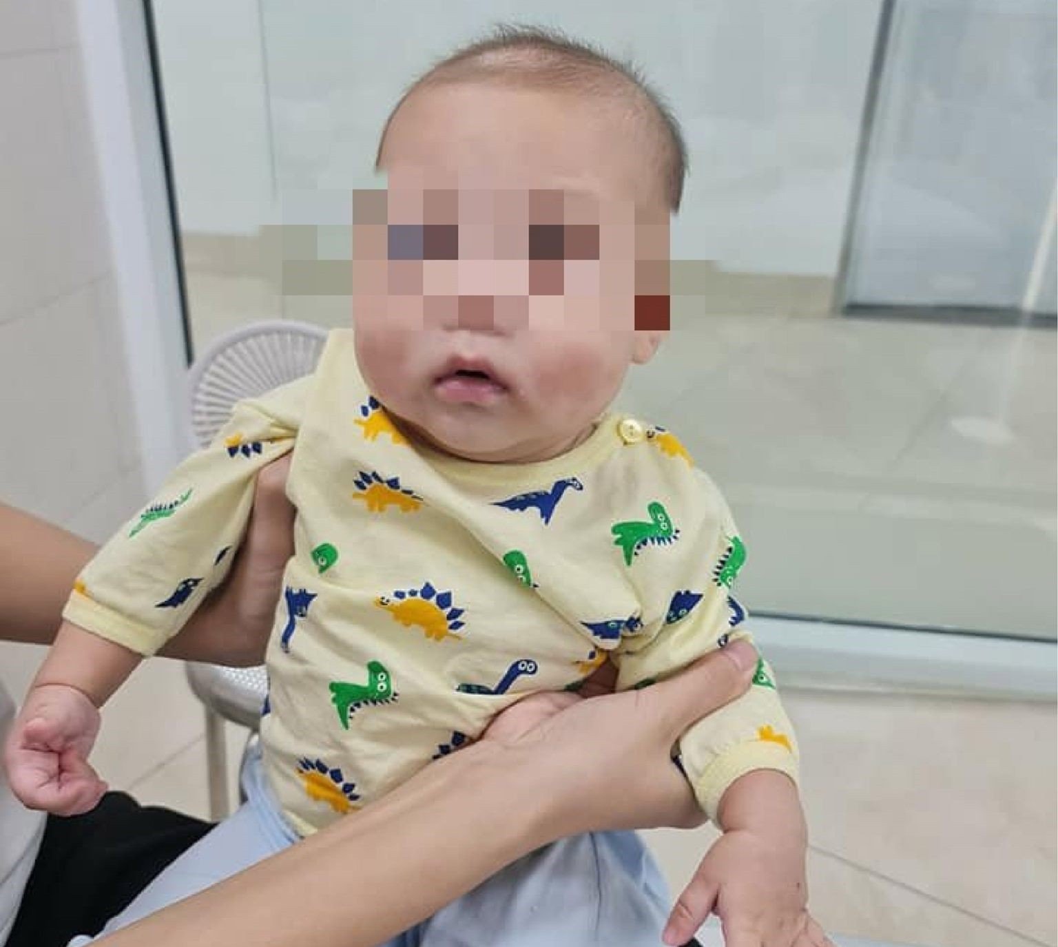 Bé trai 6 tháng tuổi ở Phú Thọ mắc bệnh siêu hiếm, chưa từng gặp tại Việt Nam - 2