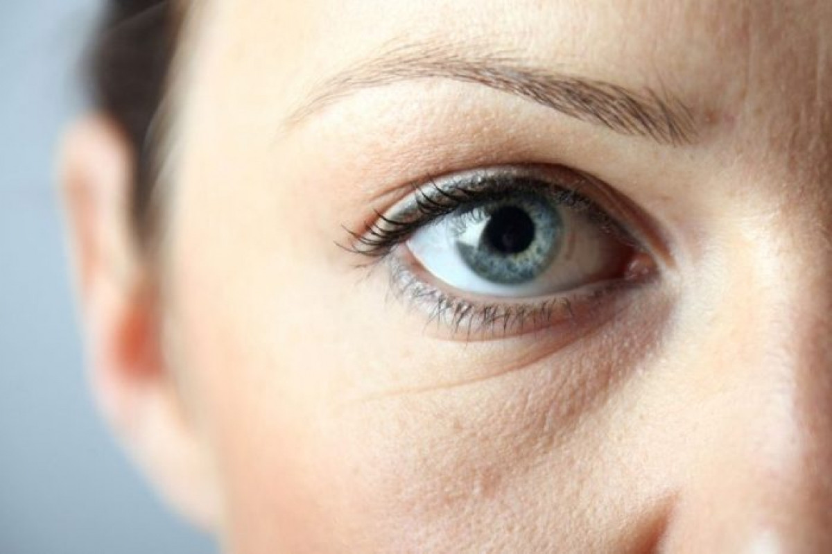 Bọng mắt và quầng thâm: Những đôi mắt lờ đờ, mệt mỏi có thể là dấu hiệu của các chứng dị ứng mãn tính. Các bệnh lý này khiến các mạch máu nở rộng và vỡ ra, gây sưng phù và thâm quầng vùng da nhạy cảm dưới mắt. Bệnh suy giáp và chứng ngưng thở khi ngủ cũng có thể là thủ phạm gây ra tình trạng này.