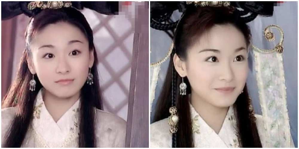 Nữ diễn viên phim 'Lương Sơn Bá - Chúc Anh Đài' bị bạn diễn tát chấn thương não - 5