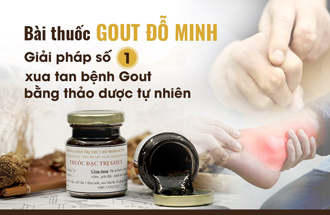 Đối phó với bệnh Gout lâu năm nhờ bài thuốc Gout Đỗ Minh 150 năm tuổi - 1