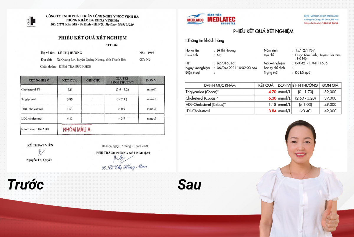 Kết quả xét nghiệm máu của cô Lê Thị Hương trước và sau khi sử dụng Mỡ máu Tâm Bình.