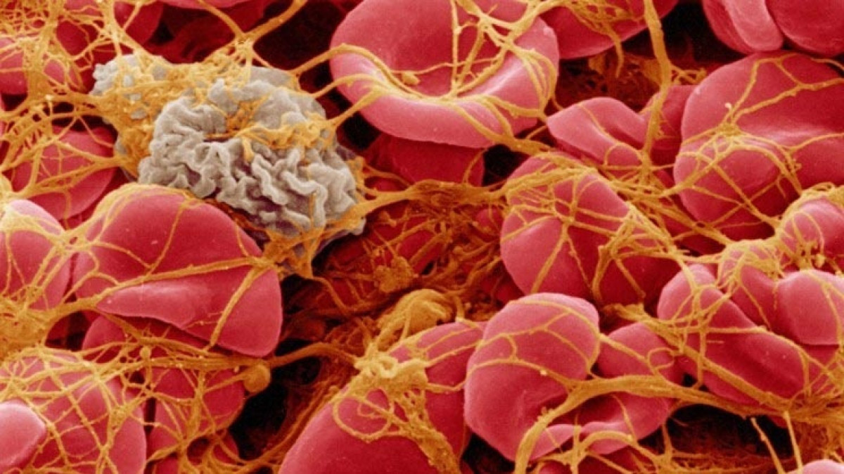 Hình ảnh qua kính hiển vi điện tử của tế bào máu đông dưới lưới fibrin. Nguồn: David Gregory & Debbie Marshall