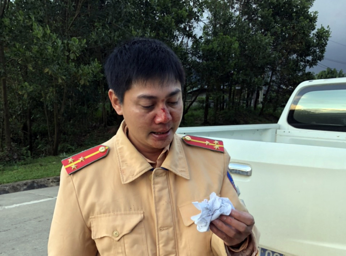 Đại úy Bùi Quang Nghĩa bị thương ở sống mũi.