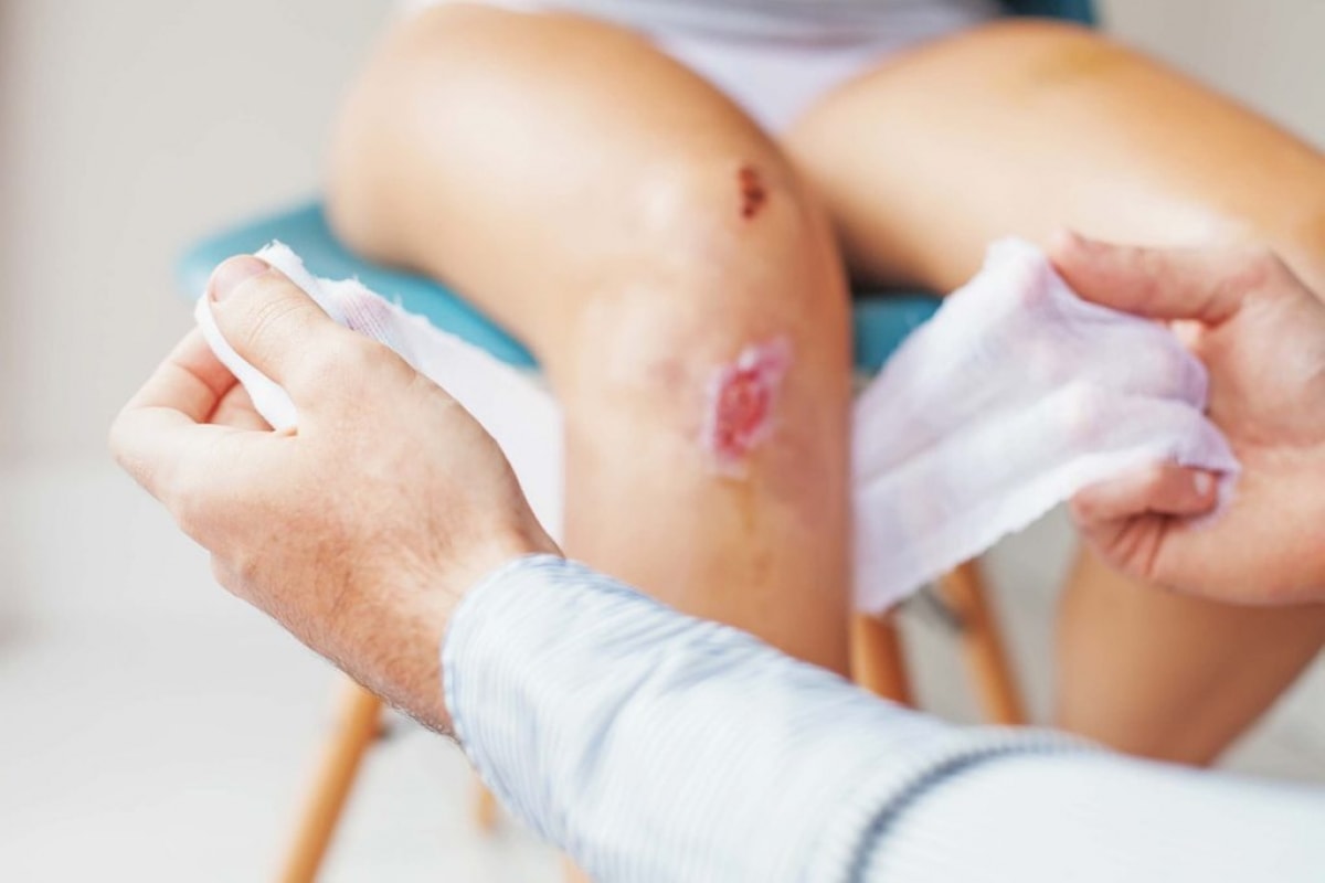 Vết xước của bạn rất sâu hoặc gây ra bởi kim loại han gỉ: Một vết xước sâu - đặc biệt là vết xước do một vật làm từ kim loại đã bị han gỉ - cần được xử lý bởi bác sĩ thay vì tự xử lý tại nhà. Những vết thương này rất dễ bị nhiễm trùng.
