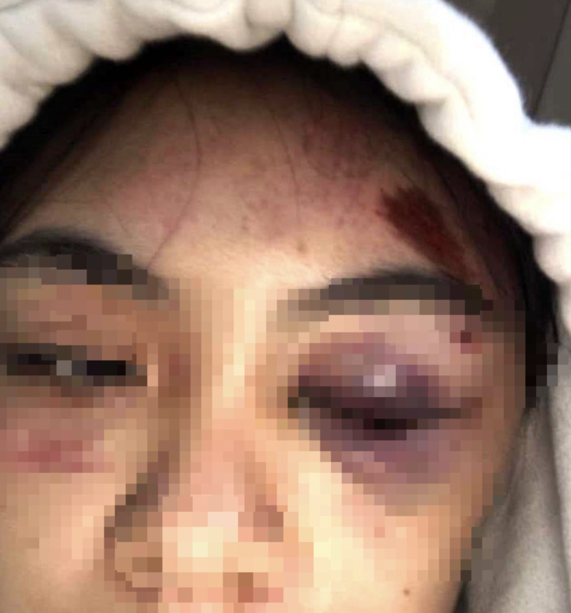 Nữ sinh bị đánh hội đồng ở Lâm Đồng : Tạm giữ hình sự 4 cô gái - 1