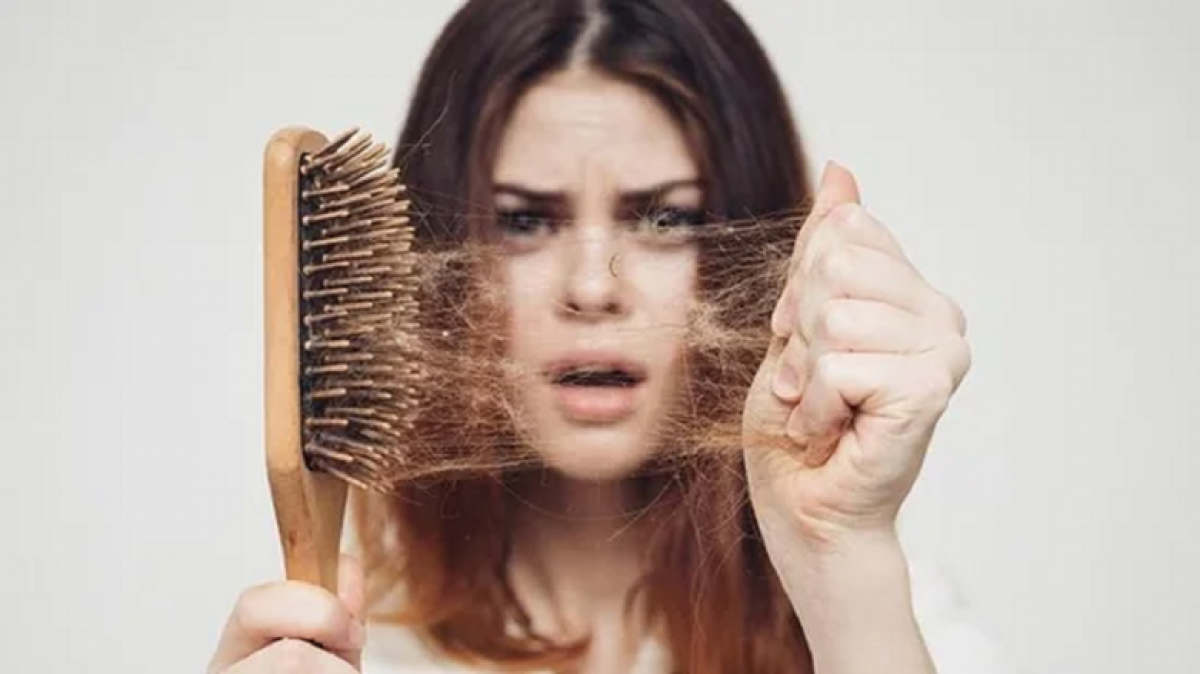 5 lý do khiến bạn bị rụng tóc nhanh  - 1