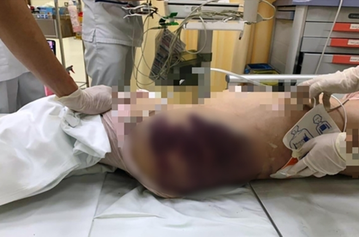 Bé gái bị 'dì ghẻ' hành hạ tới chết: Tiết lộ bất ngờ từ hiệu trưởng - 1