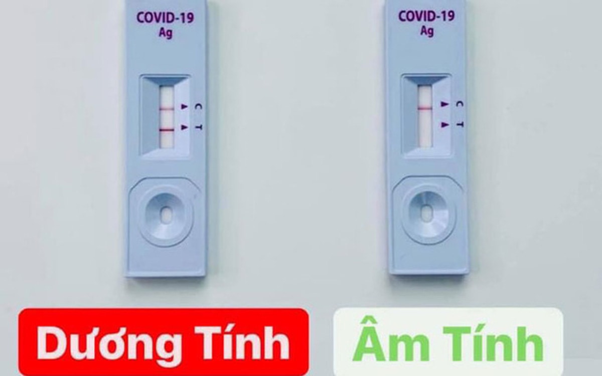Test nhanh COVID-19 một vạch: Hiện C hay T mới đúng? - 1