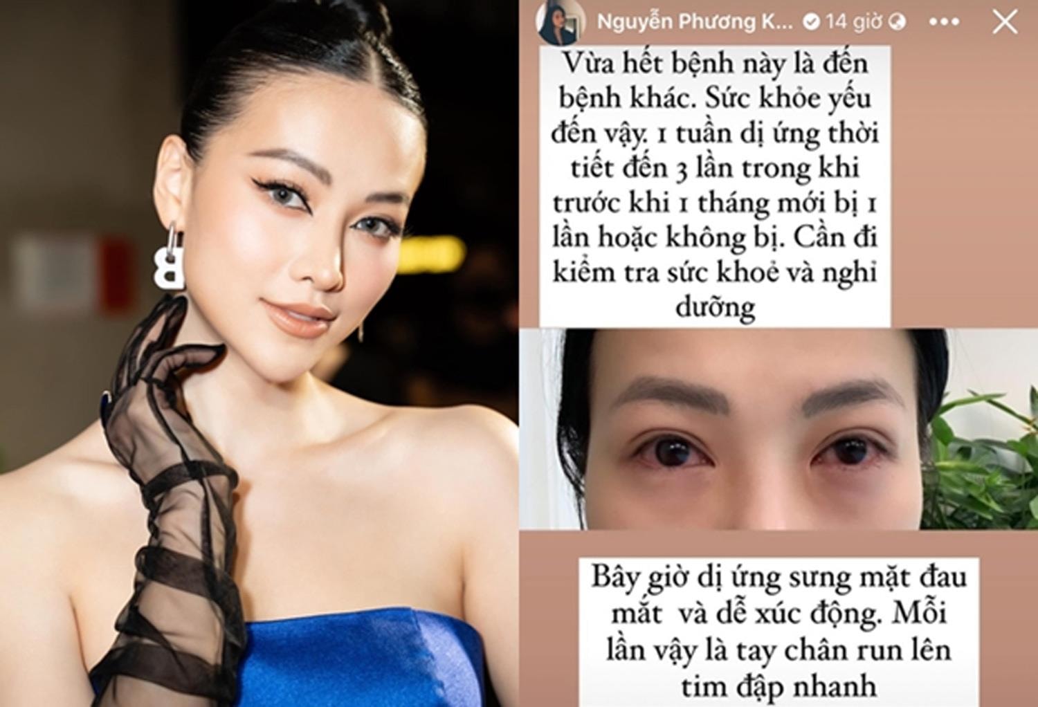 Hoa hậu Phương Khánh mặt sưng nề, mắt đỏ hoe khiến fan lo lắng - 1
