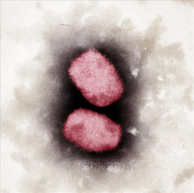 Bỉ giải trình tự gen của virus gây bệnh đậu mùa khỉ - 1