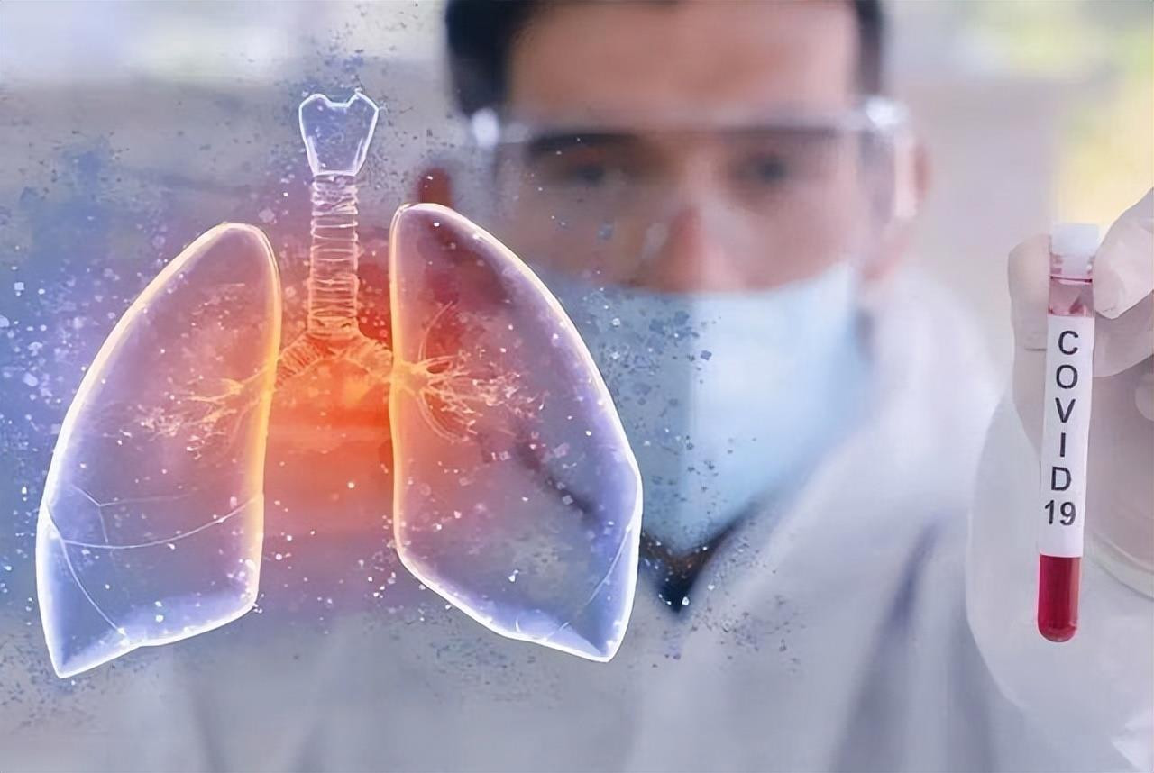 Căn bệnh phổi có tỉ lệ tử vong cao như ung thư, gặp dấu hiệu này hãy đi khám sớm - 3