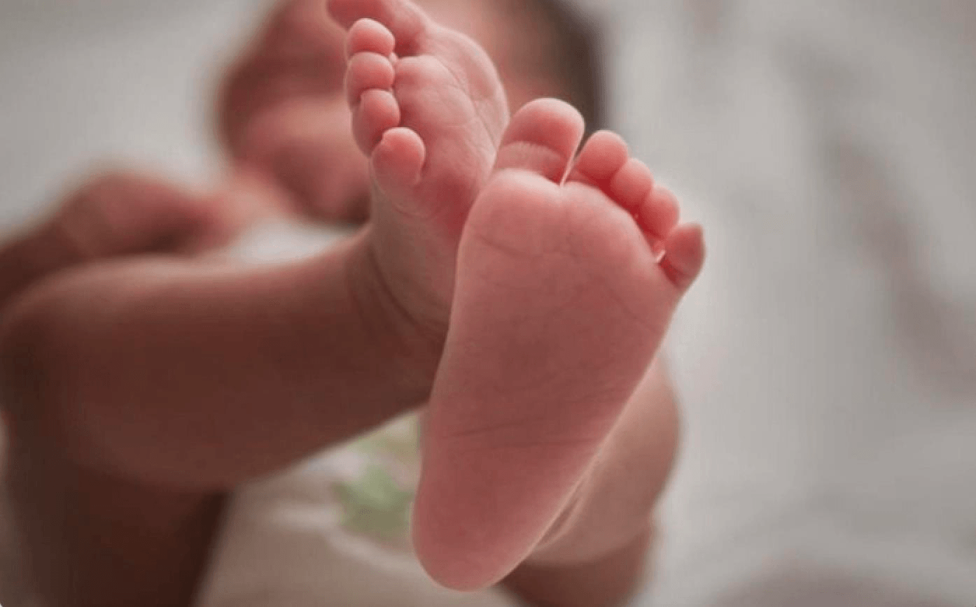 Cảnh báo: Trẻ có thể mất ngón chân vì sợi tóc rụng  - 1