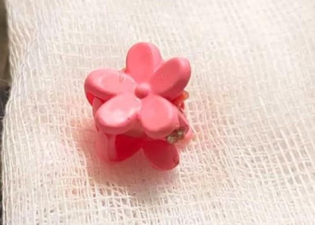 Gắp dị vật trong vùng kín bé gái 5 tuổi - 2