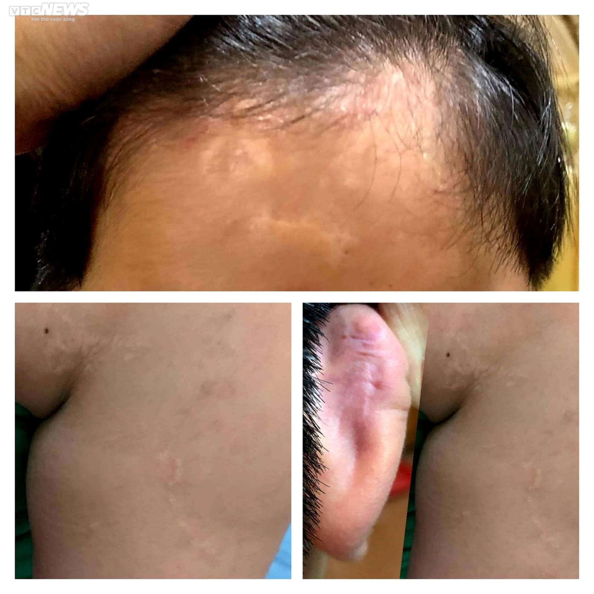 Gửi con đi chữa bệnh đau đớn nhận về hũ tro cốt: ‘Thầy Quang ác lắm mẹ ạ’ - 4