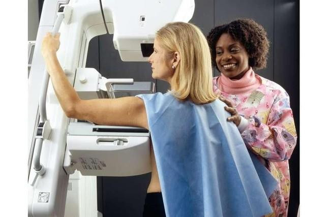 Nghiên cứu mới: Không cần chụp X-quang tuyến vú quá sớm khi tầm soát ung thư - 1