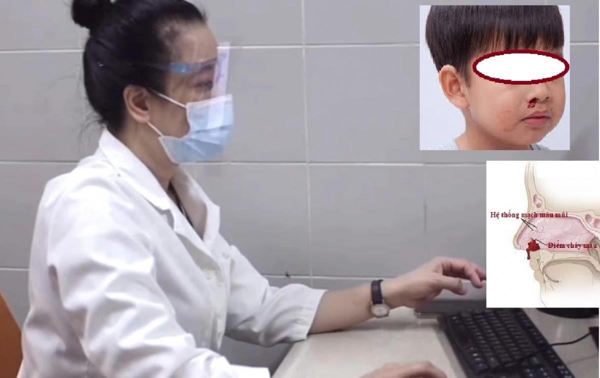 Tại sao trẻ hay bị chảy máu cam vào mùa đông? - 1