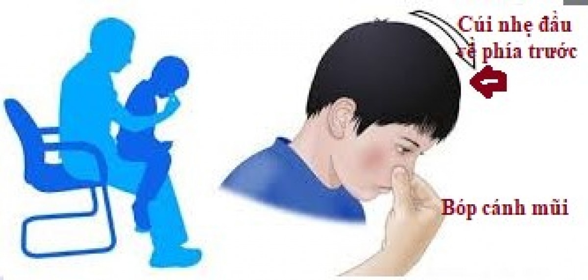 chay mau cam mua dong, co nen lo lang hay khong hinh anh 2