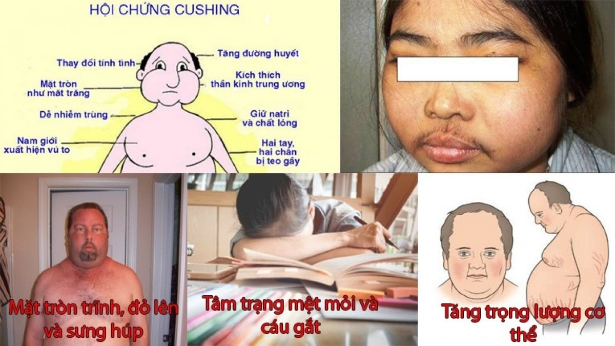 nguy hiem khon luong neu tu y su dung corticoid hinh anh 1