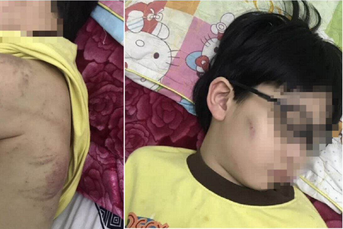 Chính quyền bác thông tin bé trai bị mẹ bạo hành phải nhập viện ở Quảng Ninh - 1