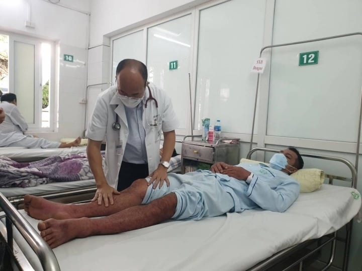 Ca mắc sốt xuất huyết điều trị tại Bệnh viện Bạch Mai.