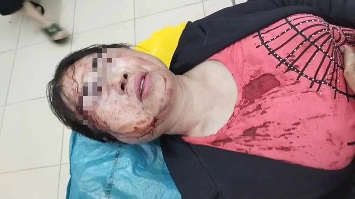 Chị Trần Thị Mai bị chồng đánh đập phải nhập viện. (Ảnh: PNVN)