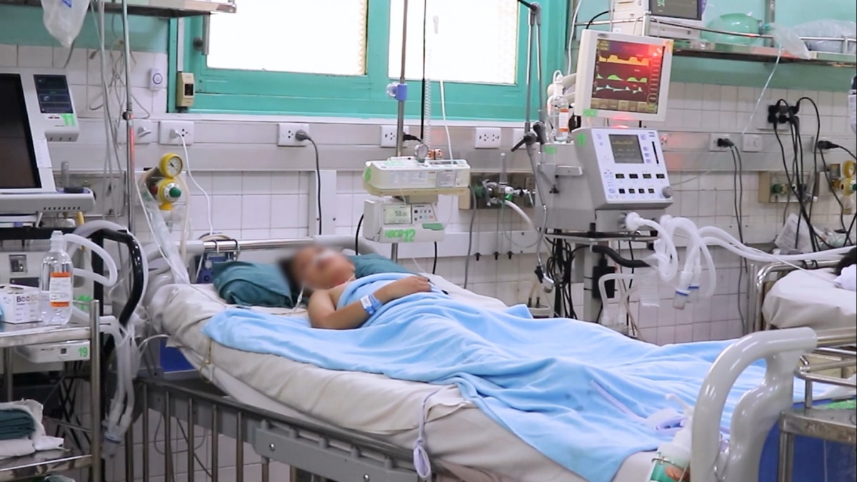 Dieu tri cho benh nhi 8 tuoi bi cua cuon cuon len cao, nguy kich vi ngung tim, ngung tho hinh anh 1