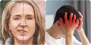 7 triệu chứng sắp bị đột quỵ cần lưu ý và xử lý ngay