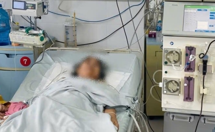 Bệnh nhân được hỗ trở bằng lọc máu tiên tục. (Ảnh: BSCC)