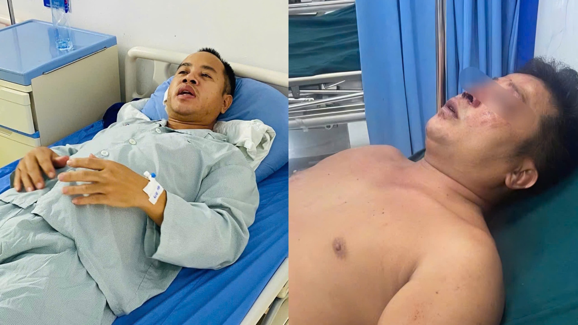 Anh Nguyễn Đức Vĩnh (bên trái) bị chấn thương phần mềm nặng, đứt một bên tai và anh Nguyễn Bá Trung bị đa chấn thương.