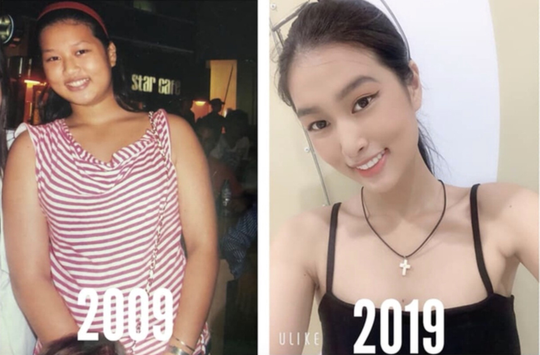 Thiên Ân từng trải qua thời gian bị miệt thị ngoại hình.