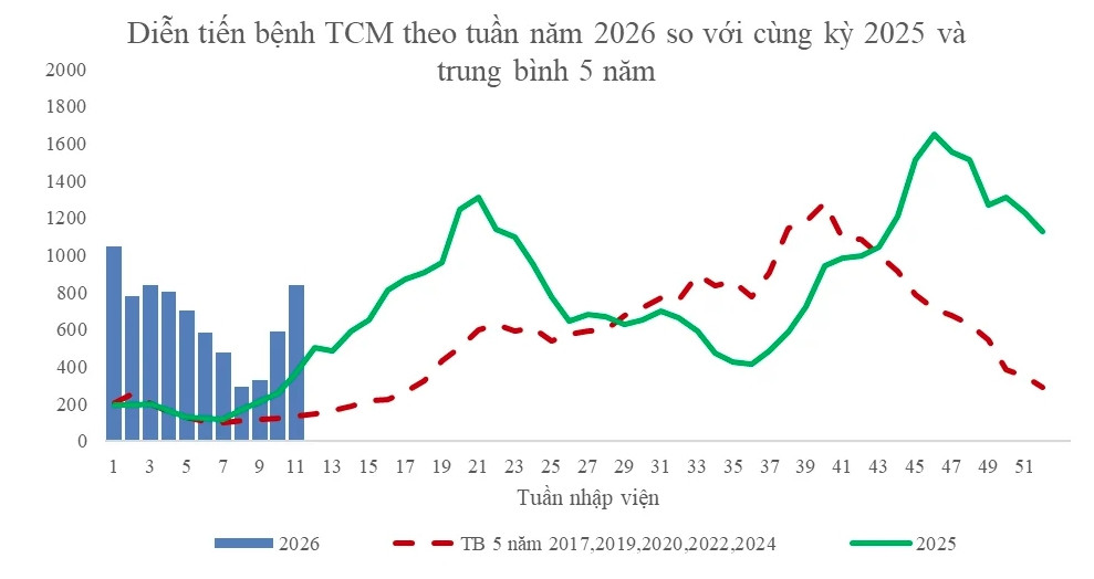 tay chan mieng vao mua Dung chu quan hinh anh 1