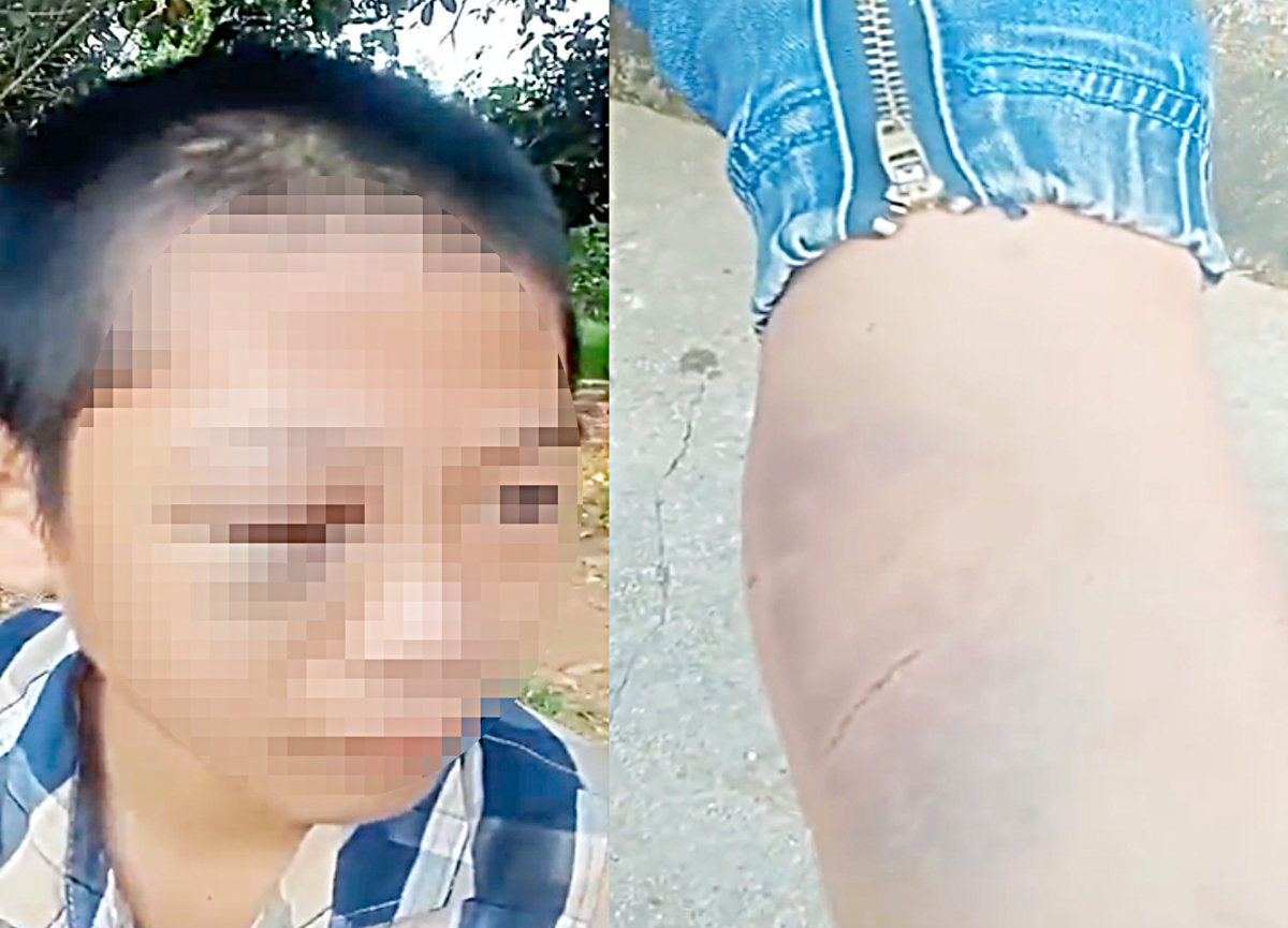 công an vào cuộc xác minh vụ bé trai lớp 6 ở nghệ an nghi bị bạo hành hình ảnh 1 cong an vao cuoc xac minh vu be trai lop 6 o nghe an nghi bi bao hanh hinh anh 1
