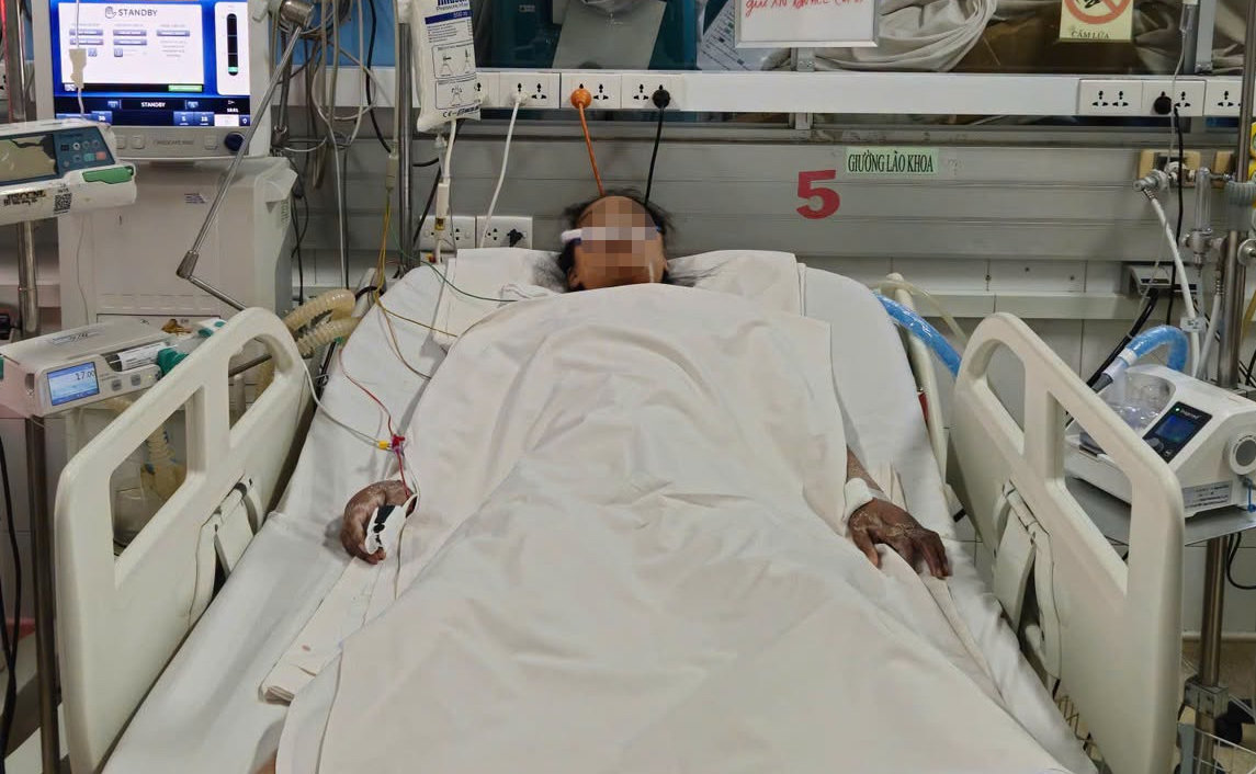 Bác sĩ cảnh báo, sốt xuất huyết có thể diễn tiến nặng, nguy hiểm tới tính mạng. (Ảnh: BVCC)