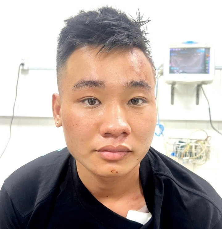 Đối tượng Nguyễn Đức Anh. (Ảnh: Công an TP Đồng Nai)