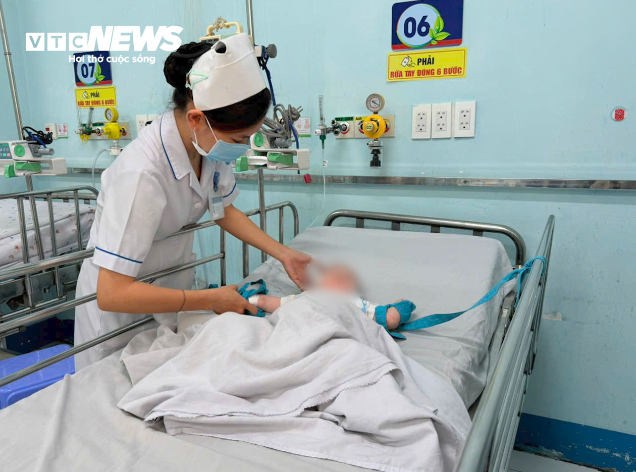 Bệnh nhi mắc tay chân miệng điều trị tại Bệnh viện Nhi Đồng 1.