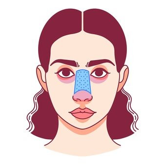 Teen có nên phẫu thuật thẩm mỹ?