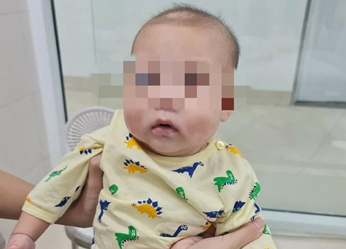 Bé trai 6 tháng tuổi ở Phú Thọ mắc bệnh siêu hiếm, chưa từng gặp tại Việt Nam