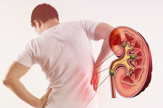Kết hợp Đông Tây y: Giải pháp chữa thận yếu, thận hư hiệu quả