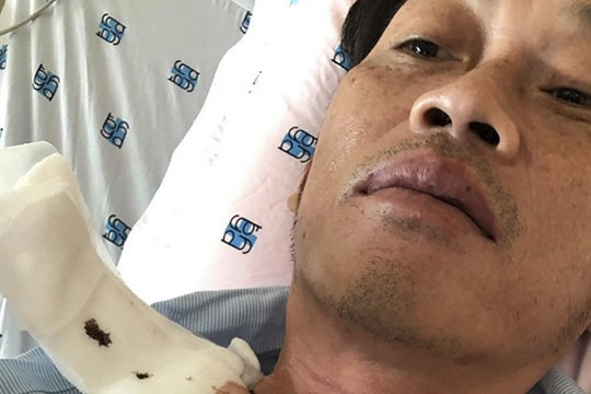 Nhiều sao Việt chia sẻ khi biết Hoài Linh bị ung thư tuyến giáp