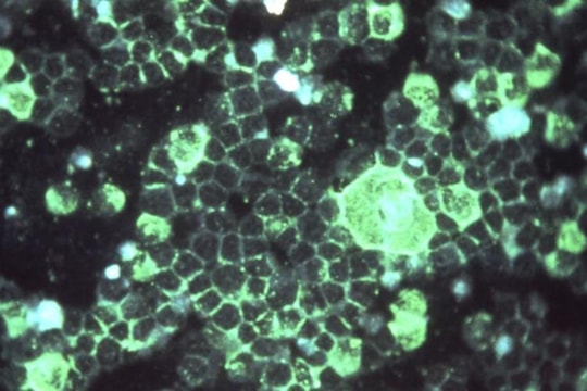 Mỹ cảnh báo sự gia tăng đột biến các ca mắc nhiễm trùng phổi ở trẻ em