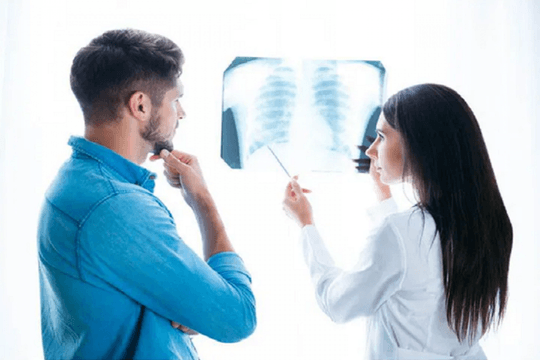 COVID-19 có thể gây tổn thương phổi lâu dài