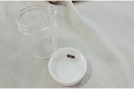 Bé gái 3 tuổi thủng ruột vì món đồ chơi quen thuộc