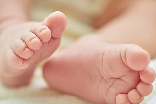 Cảnh báo: Trẻ có thể mất ngón chân vì sợi tóc rụng