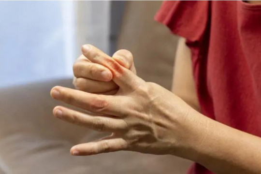 Cách kiểm soát nồng độ axit uric trong cơ thể