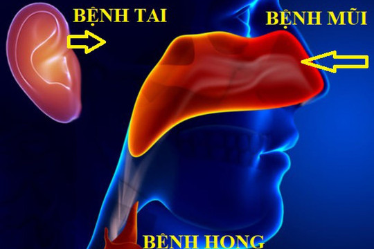 Thời tiết trở lạnh, làm gì để phòng bệnh Tai- Mũi- Họng?