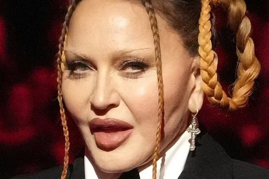 Nhan sắc nữ hoàng nhạc pop Madonna gây sốc, fan kêu gọi ngừng phẫu thuật thẩm mỹ