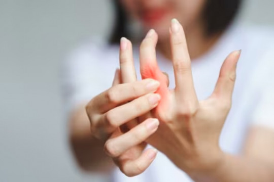5 loại trái cây giảm đau nhức xương khớp, bạn đã biết chưa?