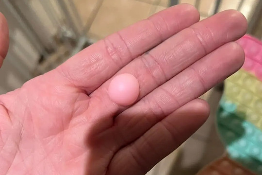 Món đồ chơi phổ biến nhưng có thể nguy hiểm tới tính mạng trẻ